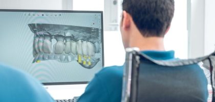 CBCT