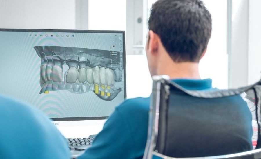 CBCT